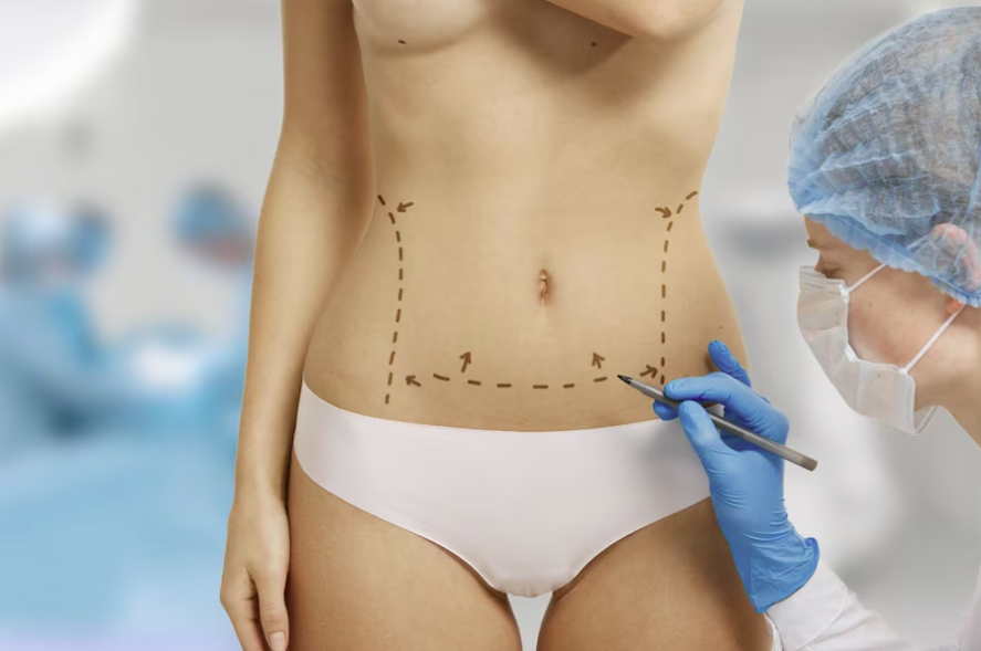 Liposuction - Travel health
